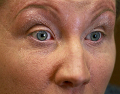 Жительница Камчатки ослепла после татуажа