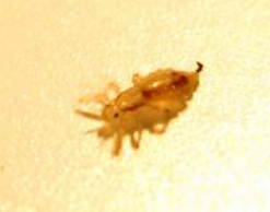 "Вшивые" города: рейтинг Роспотребнадзора